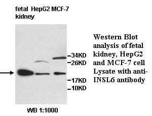 Polyclonal Rabbit anti-Human INSL6 Antibody (aa34-194, IHC, WB)