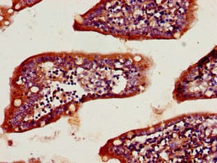 KLK2 / Kallikrein 2 Antibody