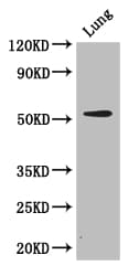CORO1A / Coronin 1a Antibody