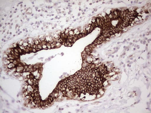 ABCB1 / MDR1 / P Glycoprotein Antibody (aa995-1280, clone OTI1A7)