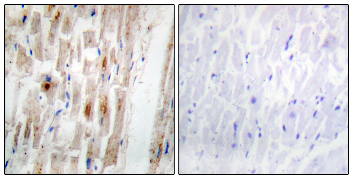 SMAD1 Antibody (phospho-Ser465)