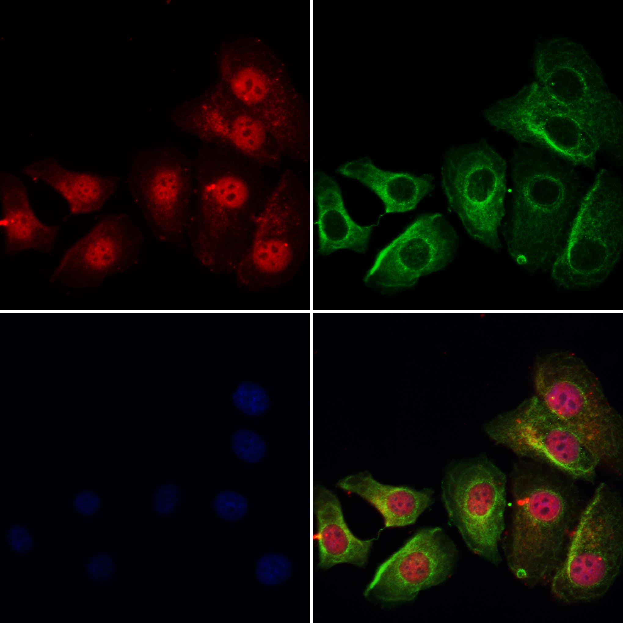 Polyclonal Rabbit anti-Human GSTZ1 Antibody (IF, WB)