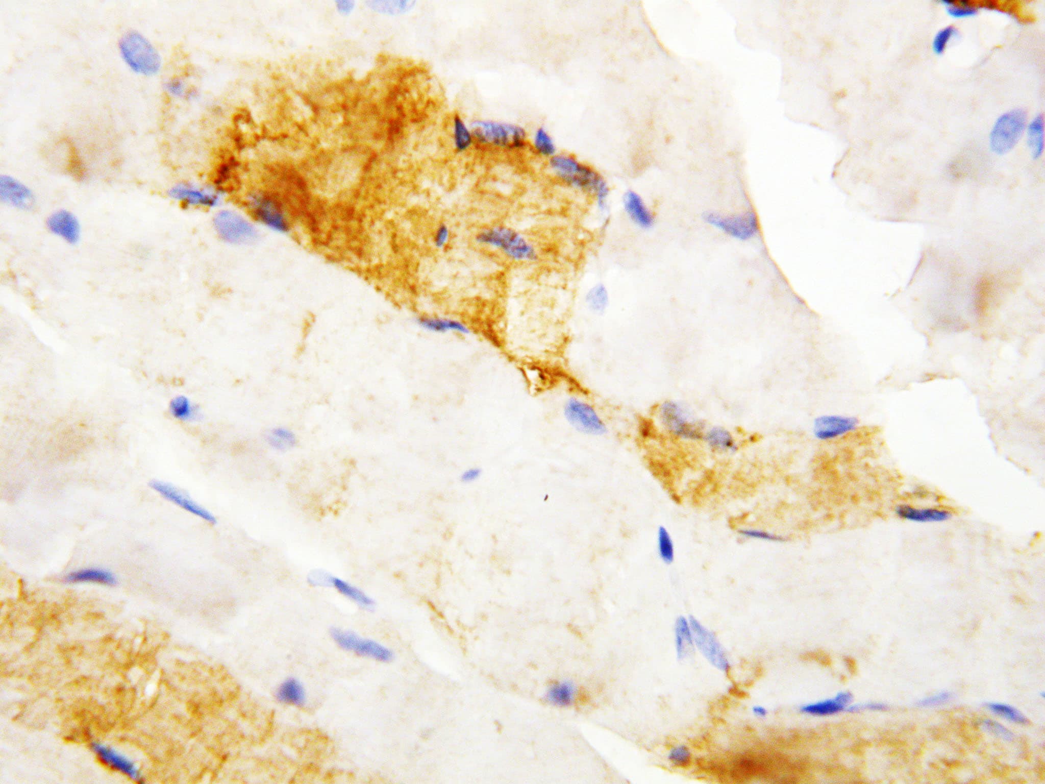CA3 / Carbonic Anhydrase III Antibody (aa2-20)