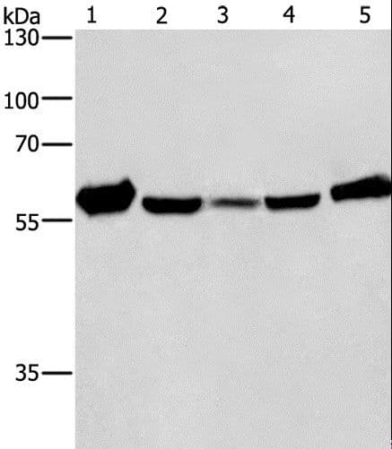 CAT / Catalase Antibody