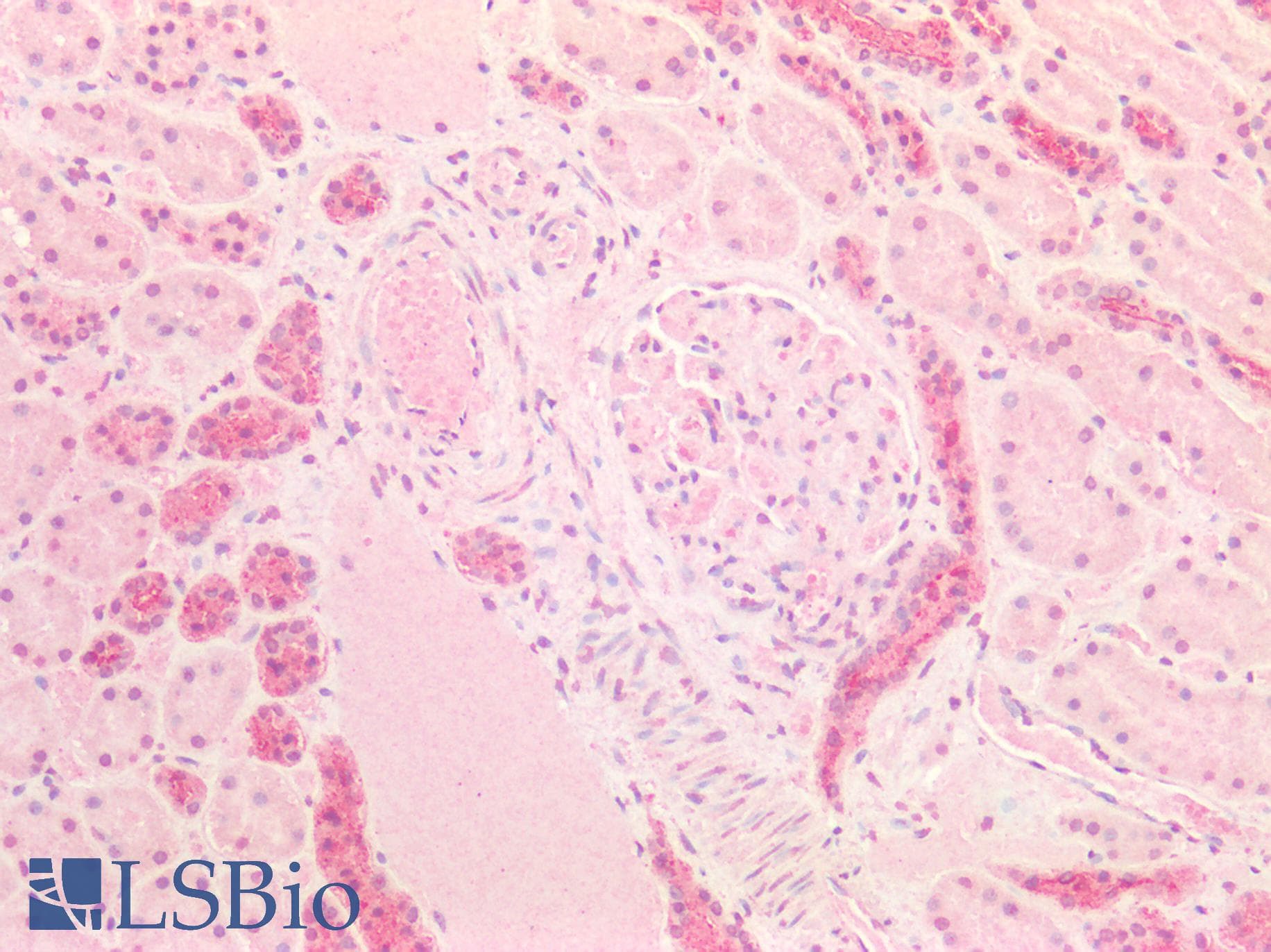 IHC-plus™ FOLR1 / Folate Receptor Alpha Antibody