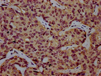 Polyclonal Rabbit anti-Human COG8 Antibody (IHC)