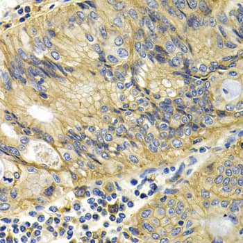 KLKB1 / Plasma Kallikrein Antibody