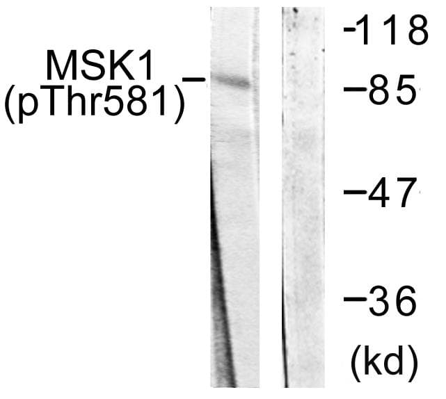 RPS6KA5 / MSK1 Antibody (p581)