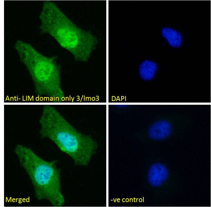 DAT1 / LMO3 Antibody (C Terminus)