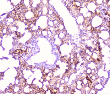 TNFRSF1A / TNFR1 Antibody