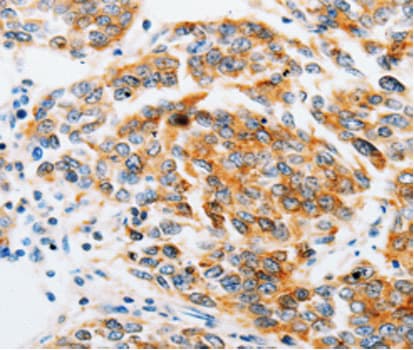 ARF6 Antibody