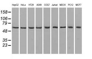 ATP5B / ATP Synthase Beta Antibody (clone OTI1B10)
