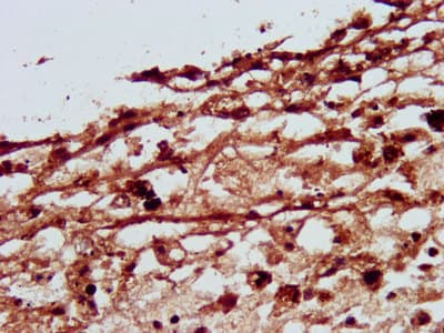 SLC26A4 / Pendrin Antibody (aa592-655)