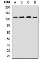 MTSS1 / MIM Antibody