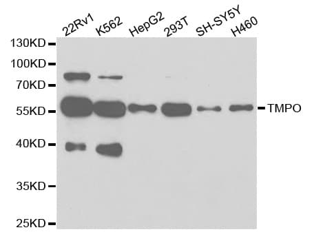 Polyclonal Rabbit anti-Human TMPO / TP / Thymopoietin Antibody (IHC, IF, WB)