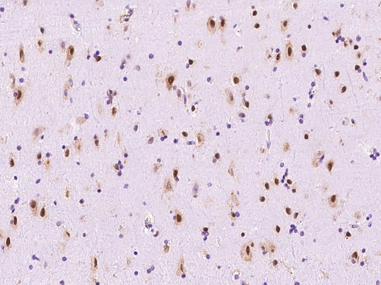 RPS6 / Ribosomal Protein S6 Antibody