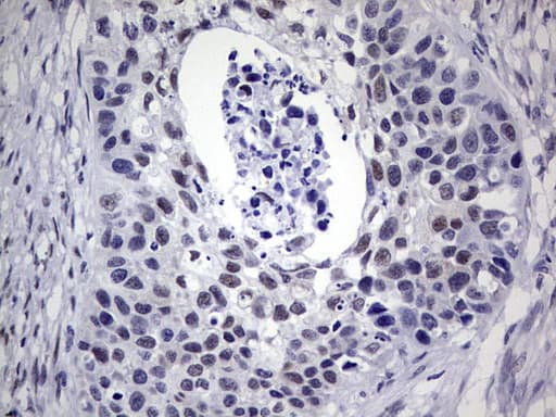 Monoclonal Mouse anti-Human RAD23B / HR23B Antibody (clone OTI7G10, aa1-253, IHC, WB)