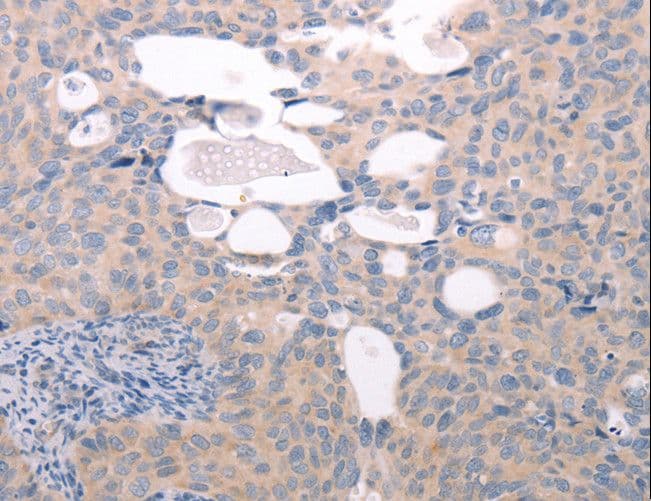 ABCF1 Antibody