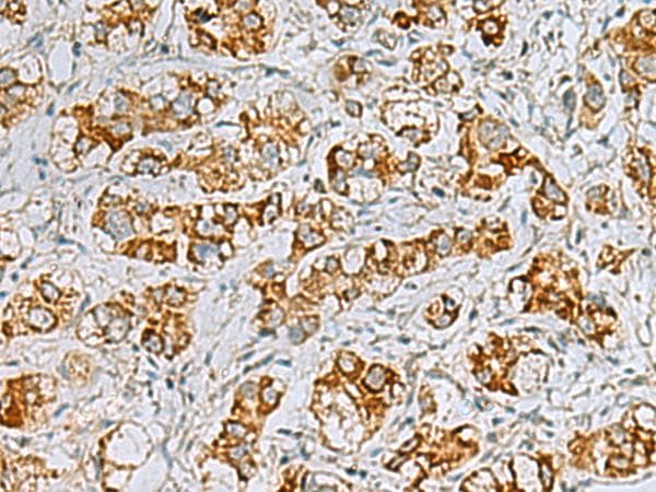 C17orf70 Antibody