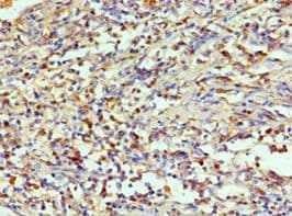 AIMP1 / EMAP II Antibody (aa25-180)