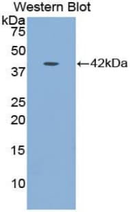 IGFBP1 Antibody (aa159-249, APC)
