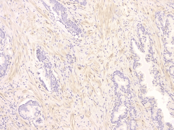 SRCIN1 / SNIP Antibody