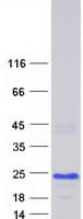 Human CNBP / ZNF9 Protein (Recombinant Myc-DDK (Flag))