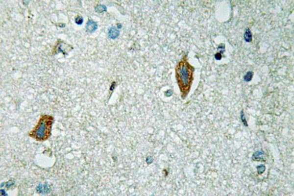 SERPINB2 / PAI-2 Antibody (aa258-307)