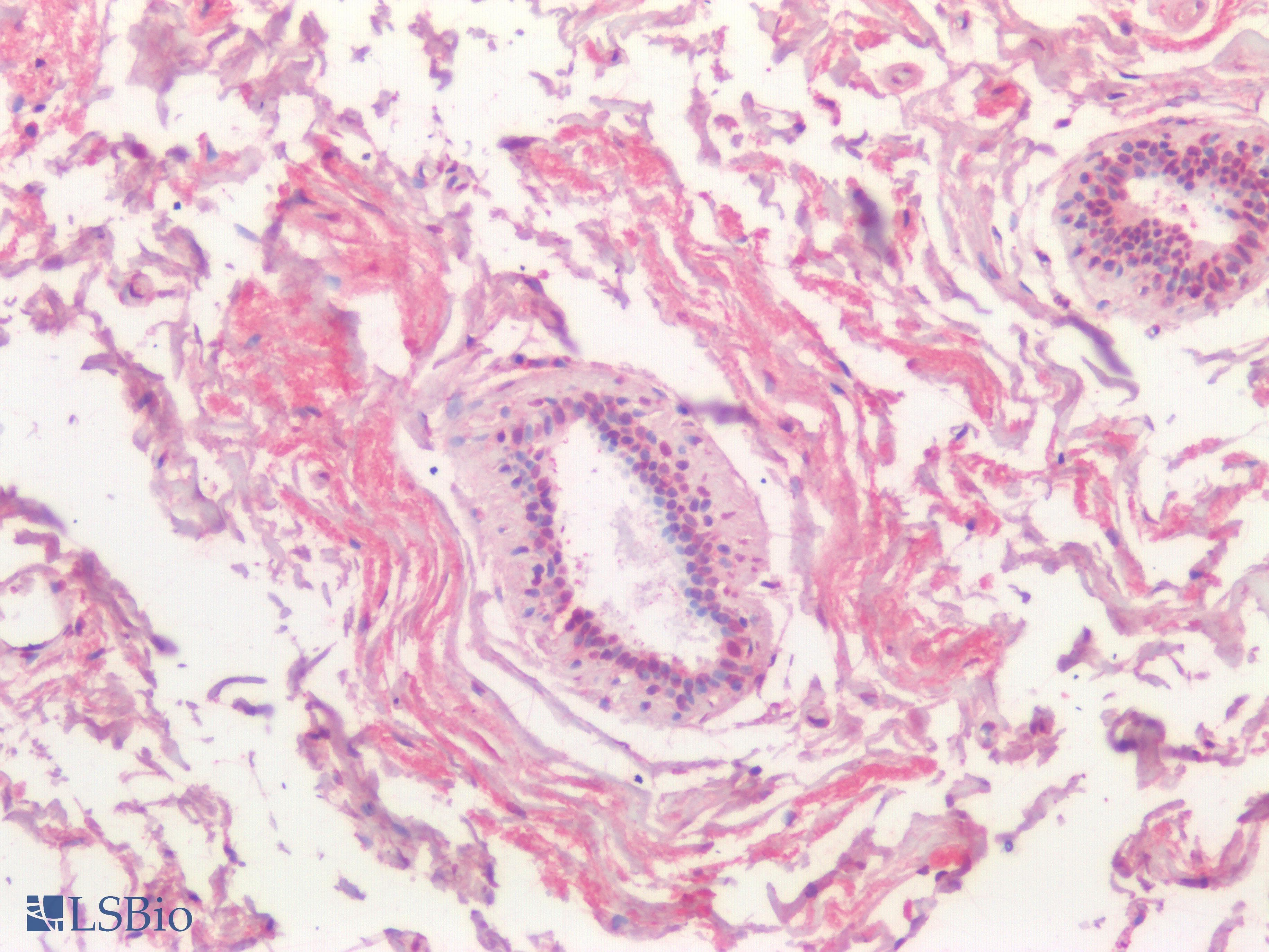 IHC-plus™ Polyclonal Rabbit anti-Human PIK3CA / PI3K Alpha Antibody (IHC)