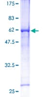 Human HEY1 Protein (Recombinant GST)