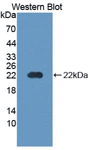 PTHR / PTHR1 Antibody (aa28-188)