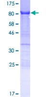 Human YTHDF3 Protein (Recombinant GST)