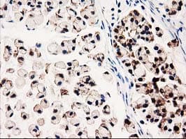 GALE / UDP-Glucose 4-Epimerase Antibody (clone OTI1C4)