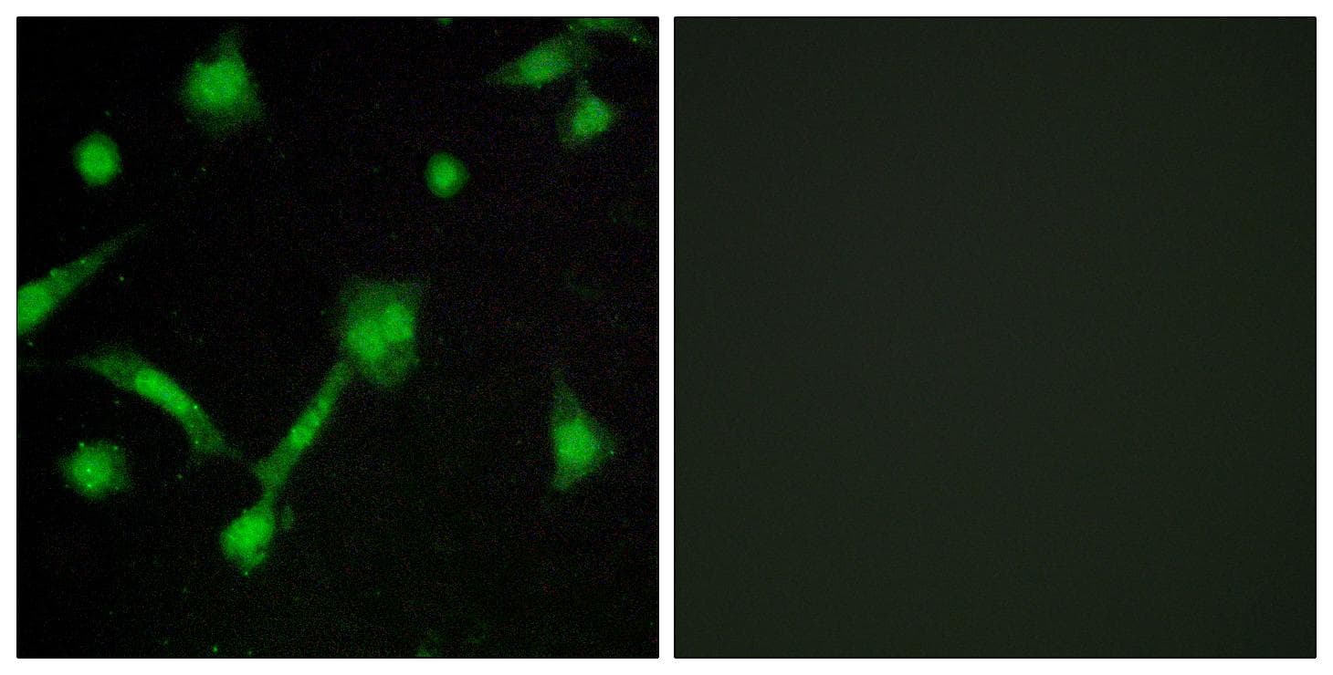 NFKBIA / IKB Alpha / IKBA Antibody (phospho-Ser32/Ser36)
