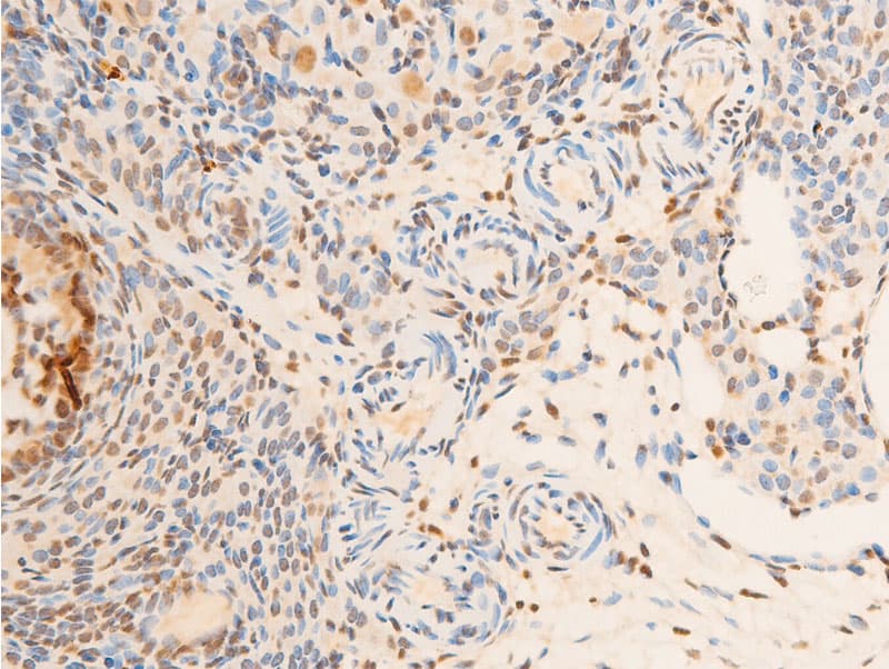 Polyclonal Rabbit anti-Human NTRK1 / TrkA Antibody (phospho-Tyr680,phospho-Tyr681, IHC, WB)
