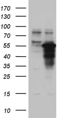 ZNF718 Antibody (clone OTI1D3, Carrier-free)