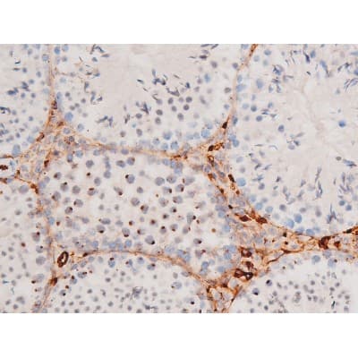 FOXO4 / AFX1 Antibody (phospho-Ser197)