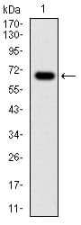 G6PD Antibody (clone 5E+12)