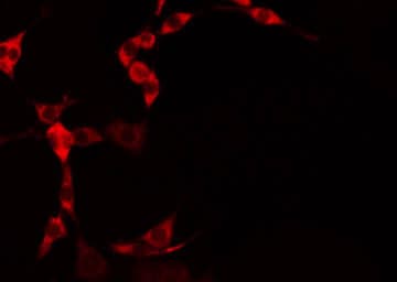 MRPS25 Antibody
