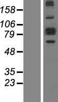 ALDH18A1 Protein (Over-Expression Lysate Myc-DDK (Flag))