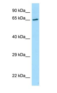 PRKCSH Antibody (aa155-204)