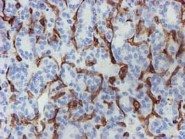 PECAM-1 / CD31 Antibody (clone OTI4C1)