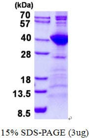 Human NEK7 Protein (Recombinant His)