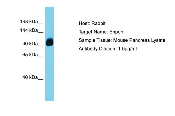 ENPEP / Aminopeptidase A Antibody (C-Terminus)
