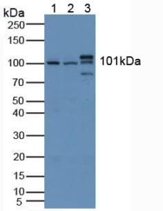 HK1 / Hexokinase 1 Antibody (aa80-215)