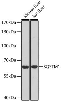 SQSTM1 Antibody