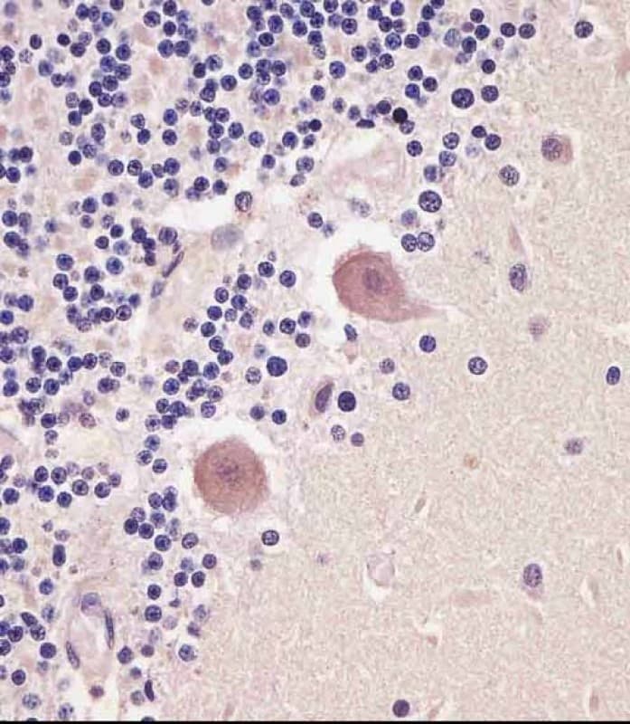 Polyclonal Rabbit anti-Human TNMD / Tenomodulin Antibody (IHC, WB)