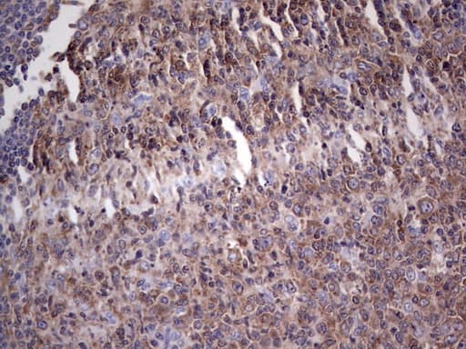 Monoclonal Mouse anti-Human PKM2 Antibody (clone 11B11, IHC, WB)