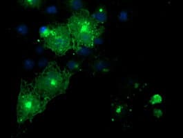 FXYD3 Antibody (clone OTI1D1)