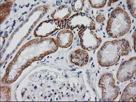 CTNNB1 / Beta Catenin Antibody (clone OTI1B11)